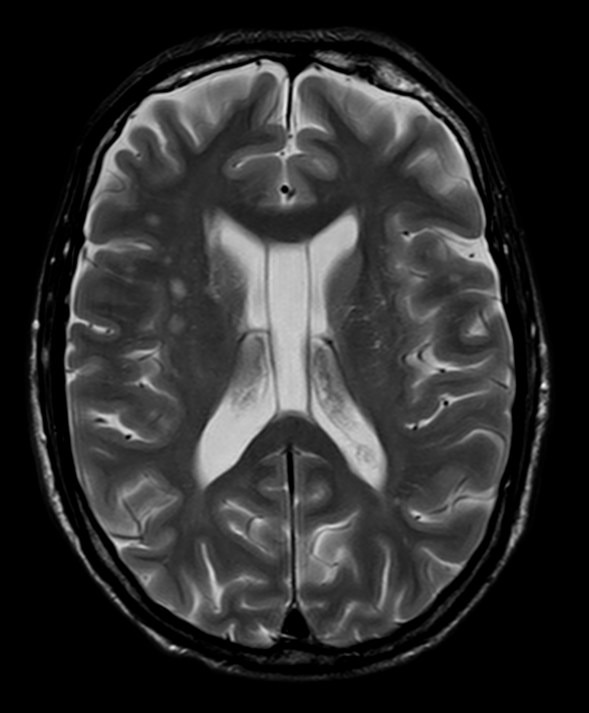 MRI — Hutchinson Clinic